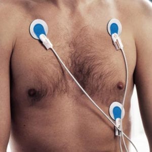 Electrodes, Ambu BlueSensor SP, 38mm,